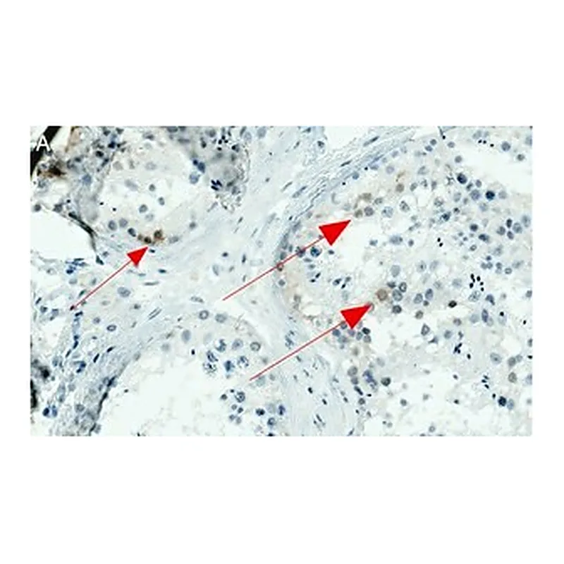 Merck Anti-NY-ESO-1 Antibody, clone 1J11 ZooMAb Rabbit Monoclonal