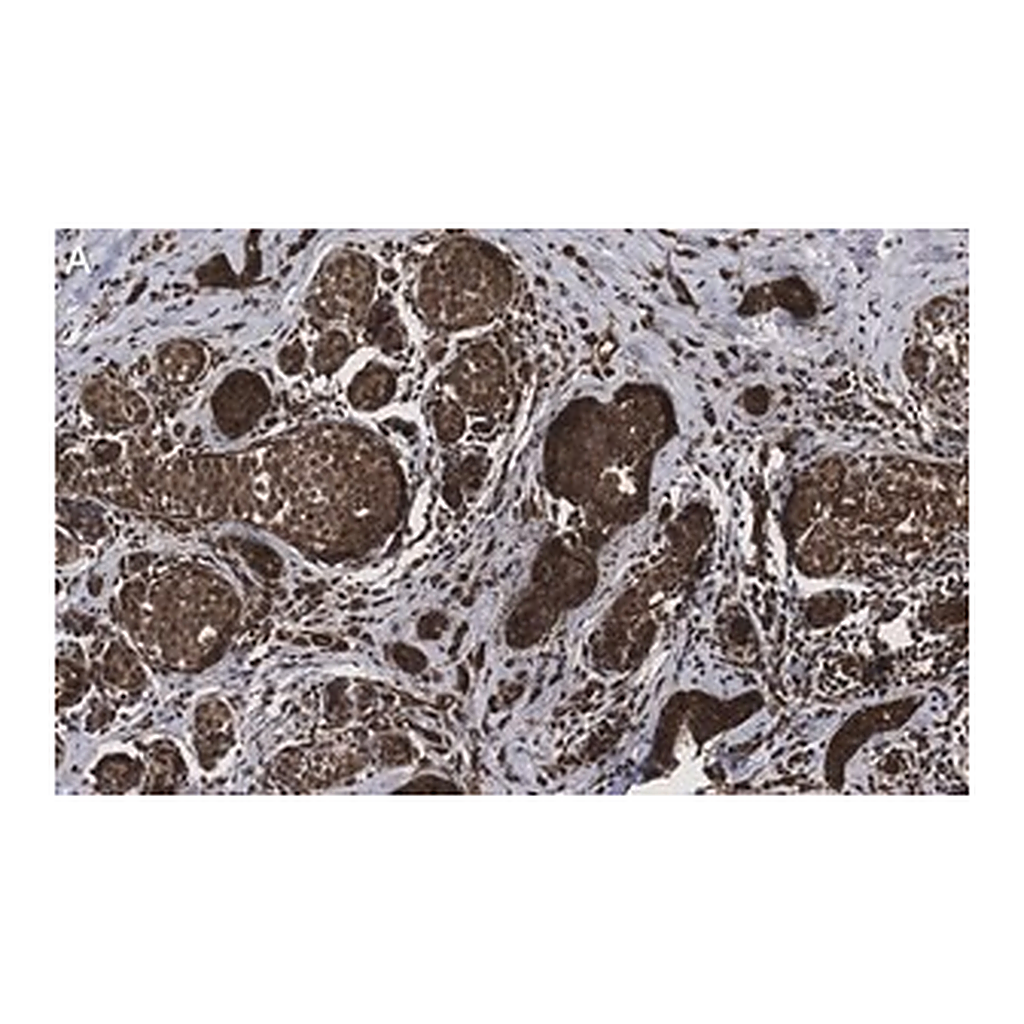 Merck Anti-phospho-HDAC4 (S246) Antibody, clone 1I14 ZooMAb Rabbit Monoclonal