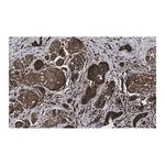 Merck Anti-phospho-HDAC4 (S246) Antibody, clone 1I14 ZooMAb Rabbit Monoclonal