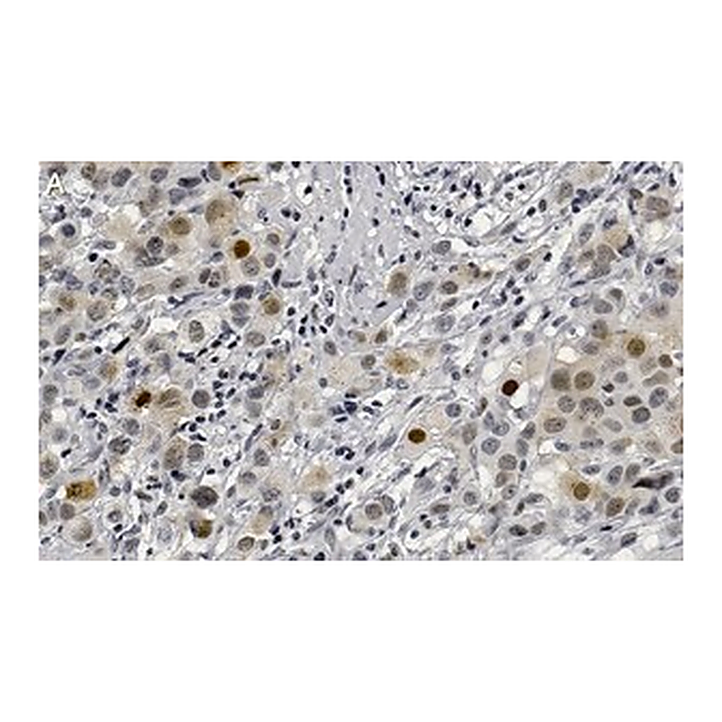 Merck Anti-Phospho-AKT1-(Ser473) Antibody, clone 1O14 ZooMAb Rabbit Monoclonal