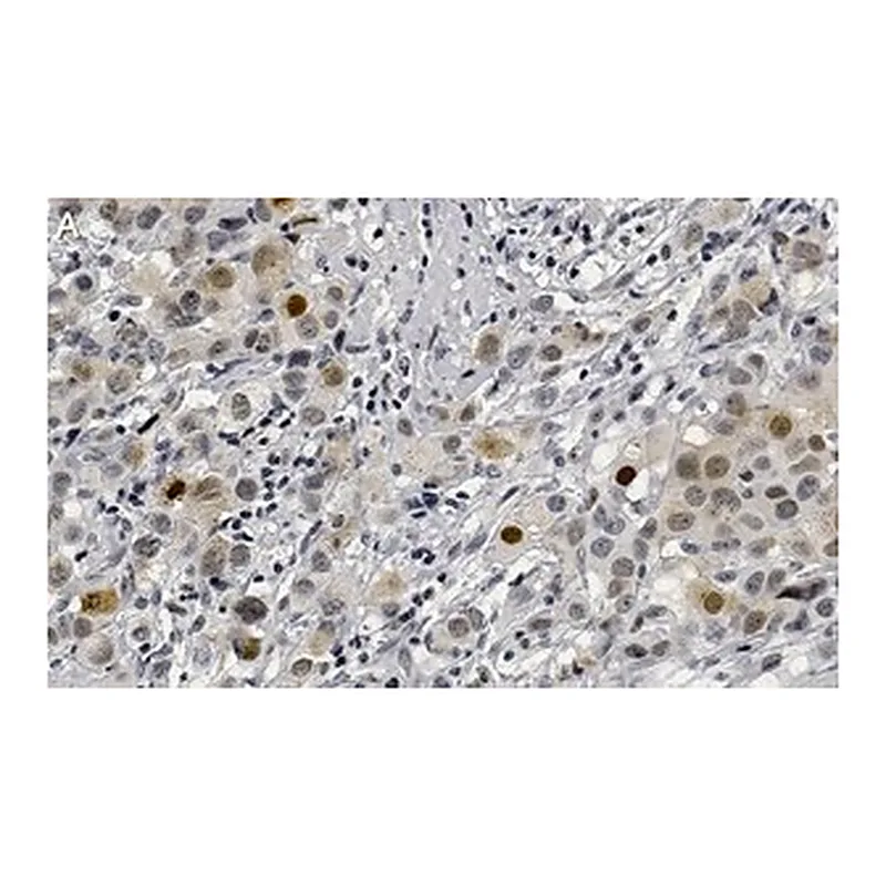 Merck Anti-Phospho-AKT1-(Ser473) Antibody, clone 1O14 ZooMAb Rabbit Monoclonal