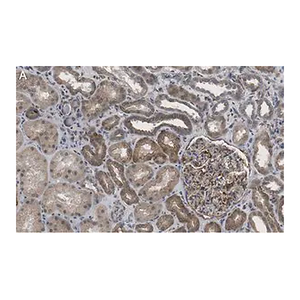 Merck Anti-Insulin Receptor β Antibody, clone 1J16 ZooMAb Rabbit Monoclonal