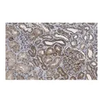 Merck Anti-Insulin Receptor β Antibody, clone 1J16 ZooMAb Rabbit Monoclonal