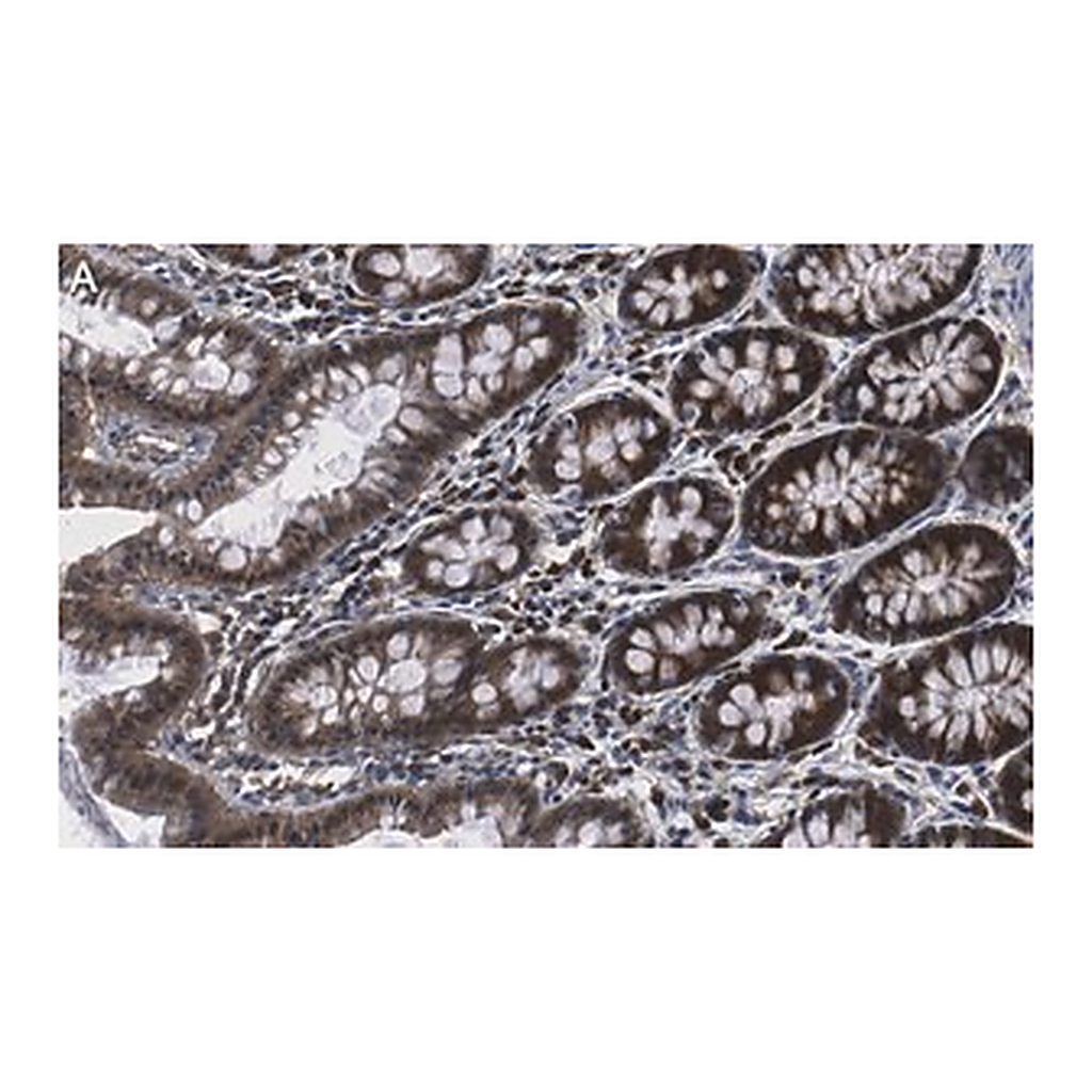Merck Anti-NME1 Antibody, clone 1H15 ZooMAb Rabbit Monoclonal