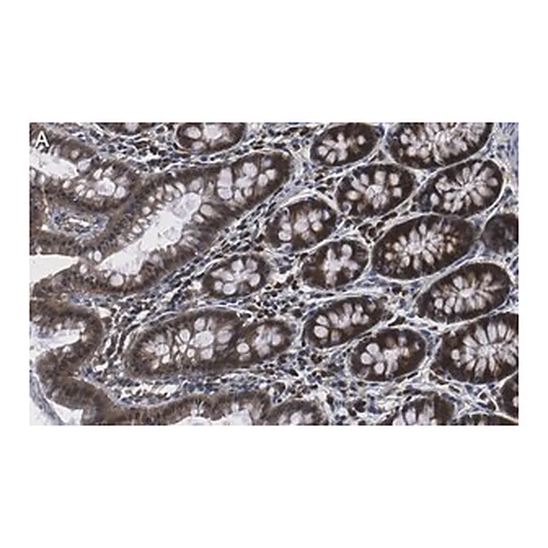 Merck Anti-NME1 Antibody, clone 1H15 ZooMAb Rabbit Monoclonal