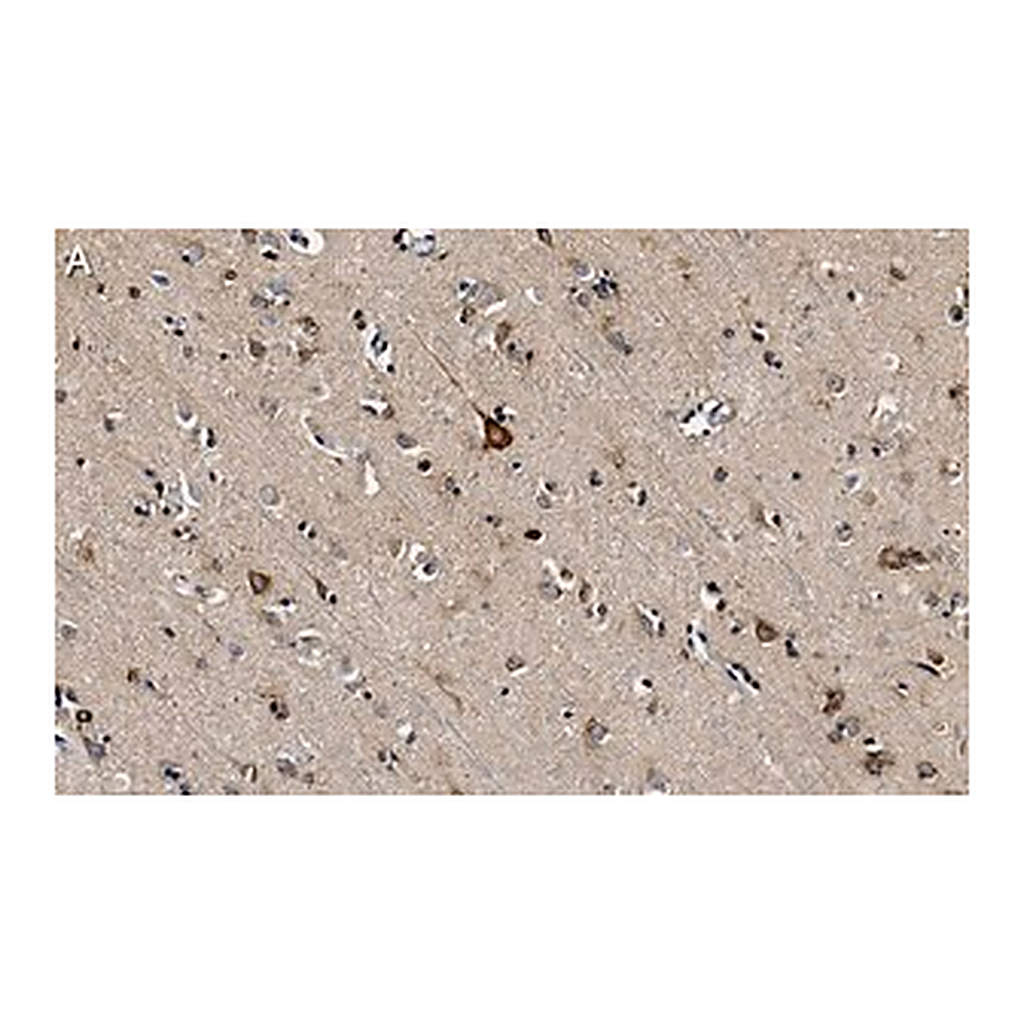 Merck Anti-PKCα Antibody, clone 2H22 ZooMAb Rabbit Monoclonal