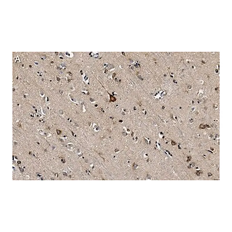 Merck Anti-PKCα Antibody, clone 2H22 ZooMAb Rabbit Monoclonal