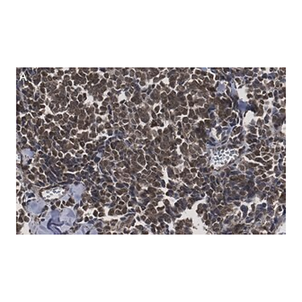Merck Anti-Myogenin Antibody, clone 1M17 ZooMAb Rabbit Monoclonal