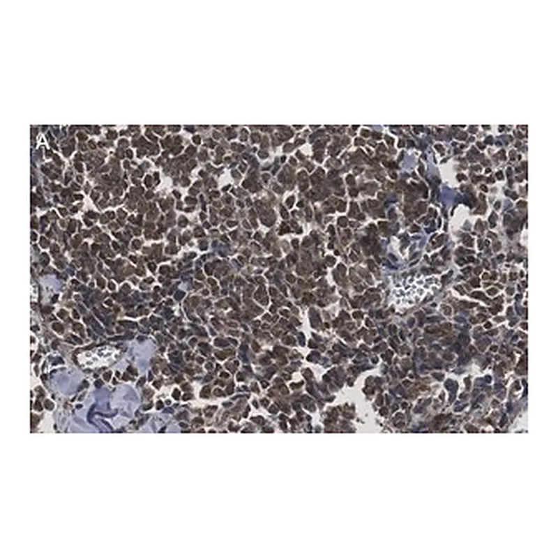 Merck Anti-Myogenin Antibody, clone 1M17 ZooMAb Rabbit Monoclonal
