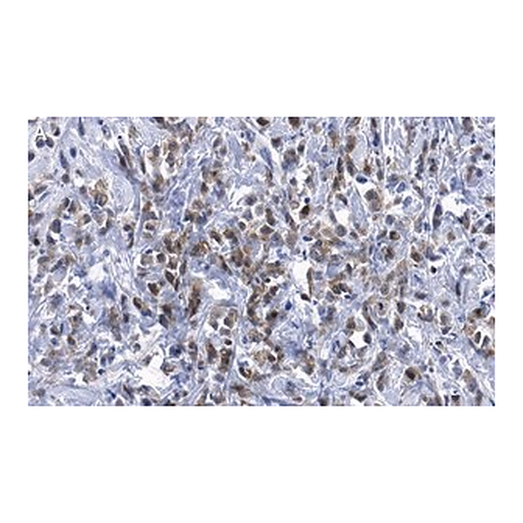 Merck Anti-Cdk4 Antibody, clone 1E19 ZooMAb Rabbit Monoclonal