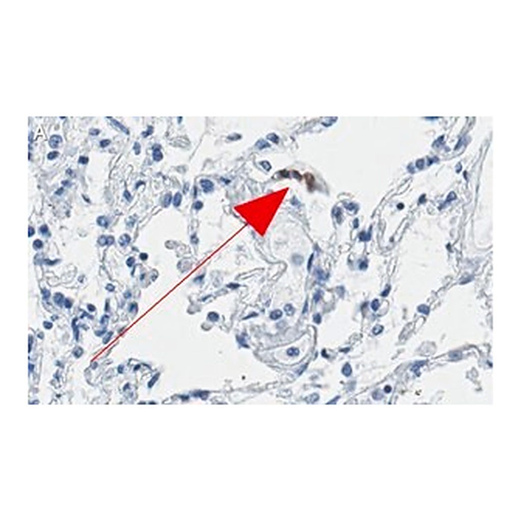 Merck Anti-ACE2-cytoplasmic Antibody, clone 1C17 ZooMAb Rabbit Monoclonal