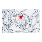 Merck Anti-ACE2-cytoplasmic Antibody, clone 1C17 ZooMAb Rabbit Monoclonal