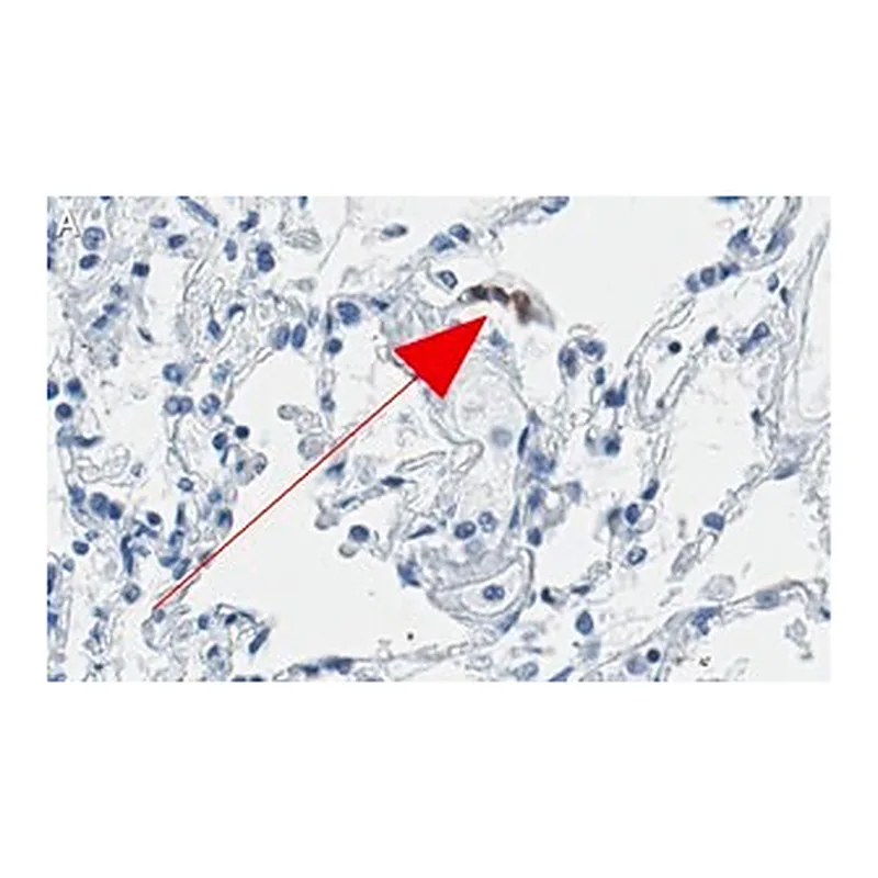 Merck Anti-ACE2-cytoplasmic Antibody, clone 1C17 ZooMAb Rabbit Monoclonal