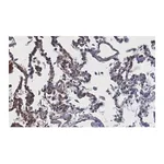 Merck Anti-ACE2-extracellular Antibody, clone 1F21 ZooMAb Rabbit Monoclonal