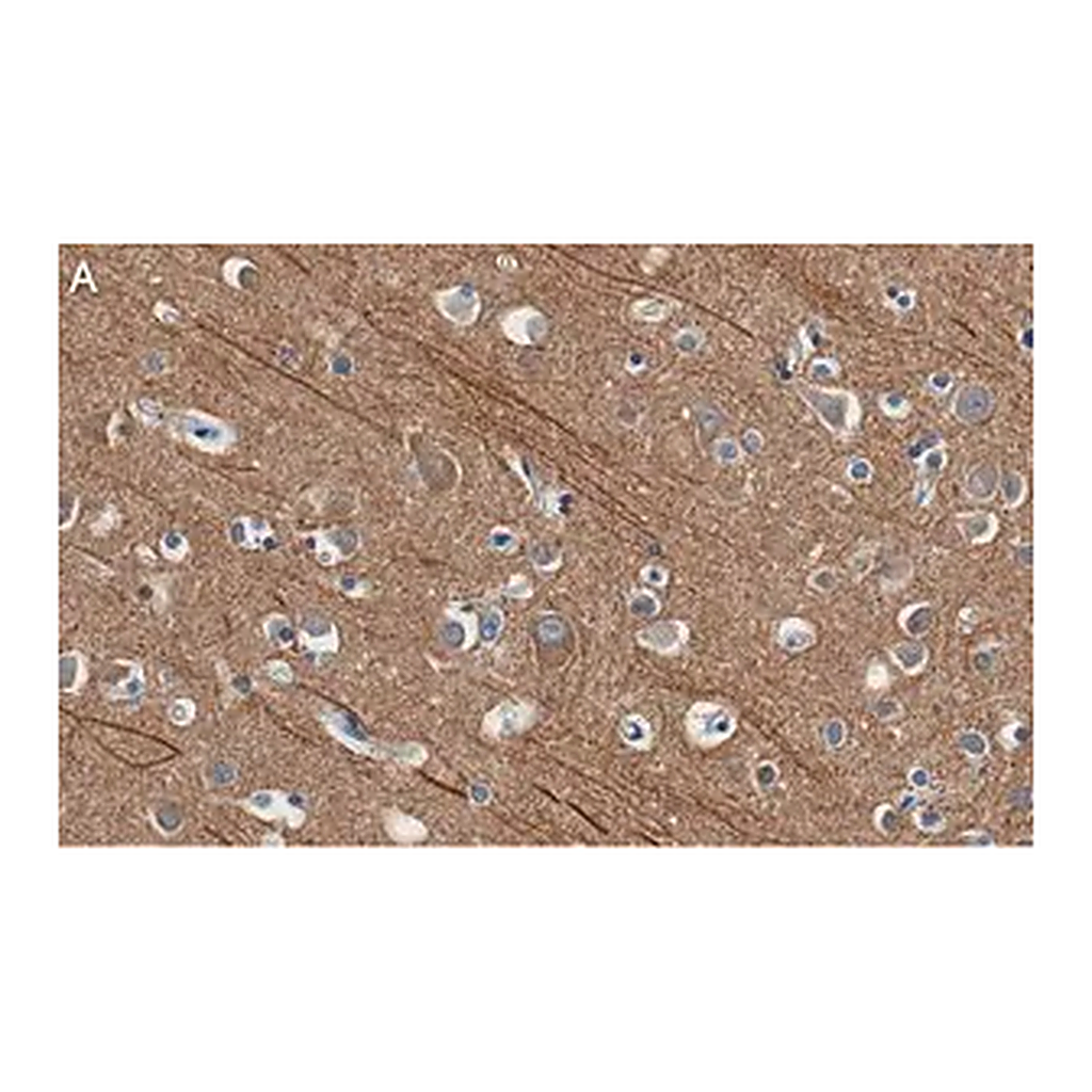 Merck Anti-Presenilin-1 Antibody, clone 2O13 ZooMAb Rabbit Monoclonal