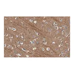 Merck Anti-Presenilin-1 Antibody, clone 2O13 ZooMAb Rabbit Monoclonal
