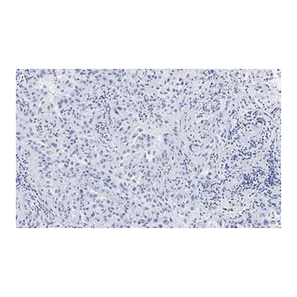 Merck Anti-Integrin αVβ8 Antibody, clone EM13309 , ZooMAb Rabbit Monoclonal