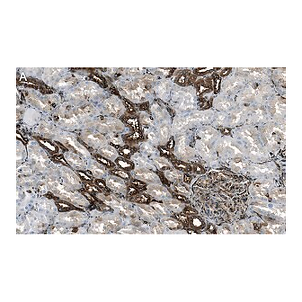 Merck Anti-Filamin A Antibody, clone 1D12 ZooMAb Rabbit Monoclonal