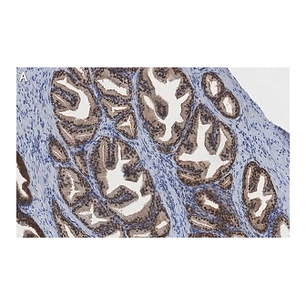 Merck Anti-PRMT5 Antibody, clone 1H16 ZooMAb Rabbit Monoclonal