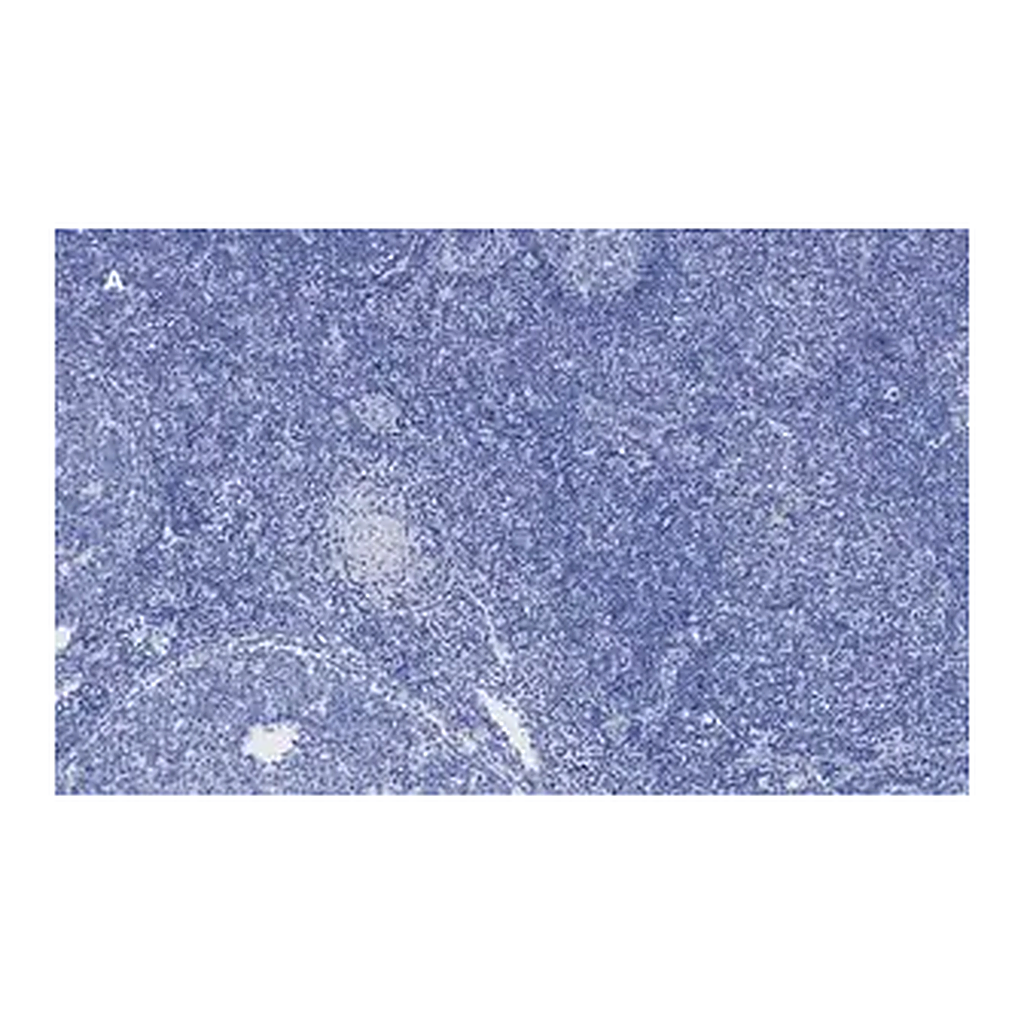 Merck Anti-Ki67 Antibody, clone 1O15, ZooMAb Rabbit Monoclonal
