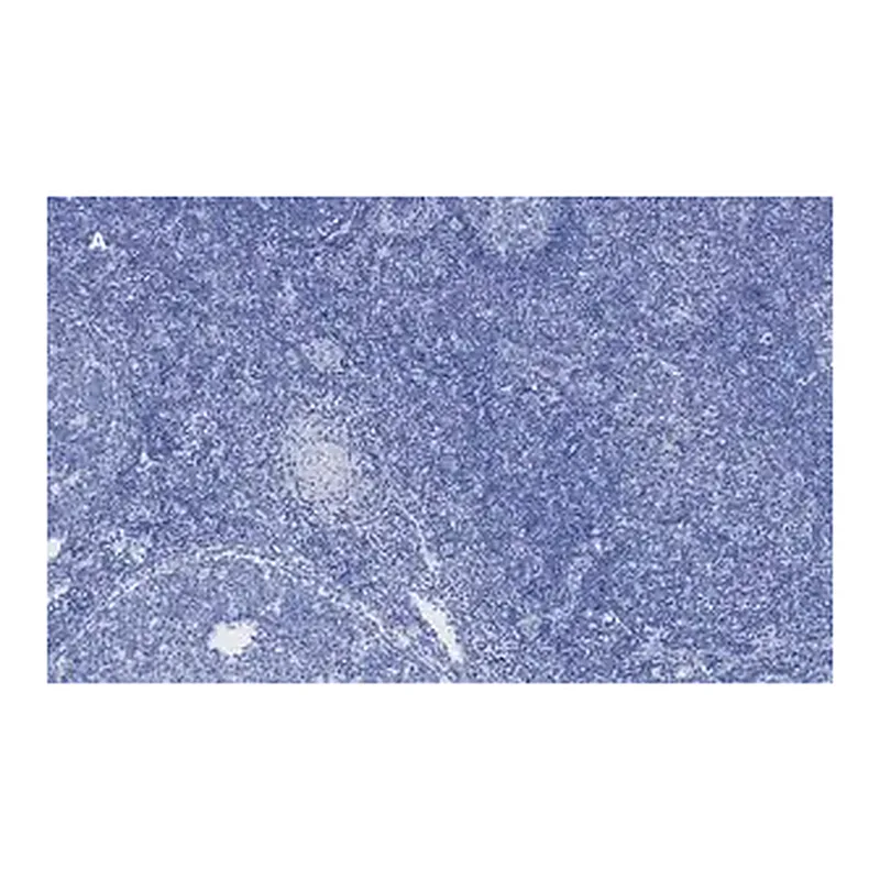 Merck Anti-Ki67 Antibody, clone 1O15, ZooMAb Rabbit Monoclonal