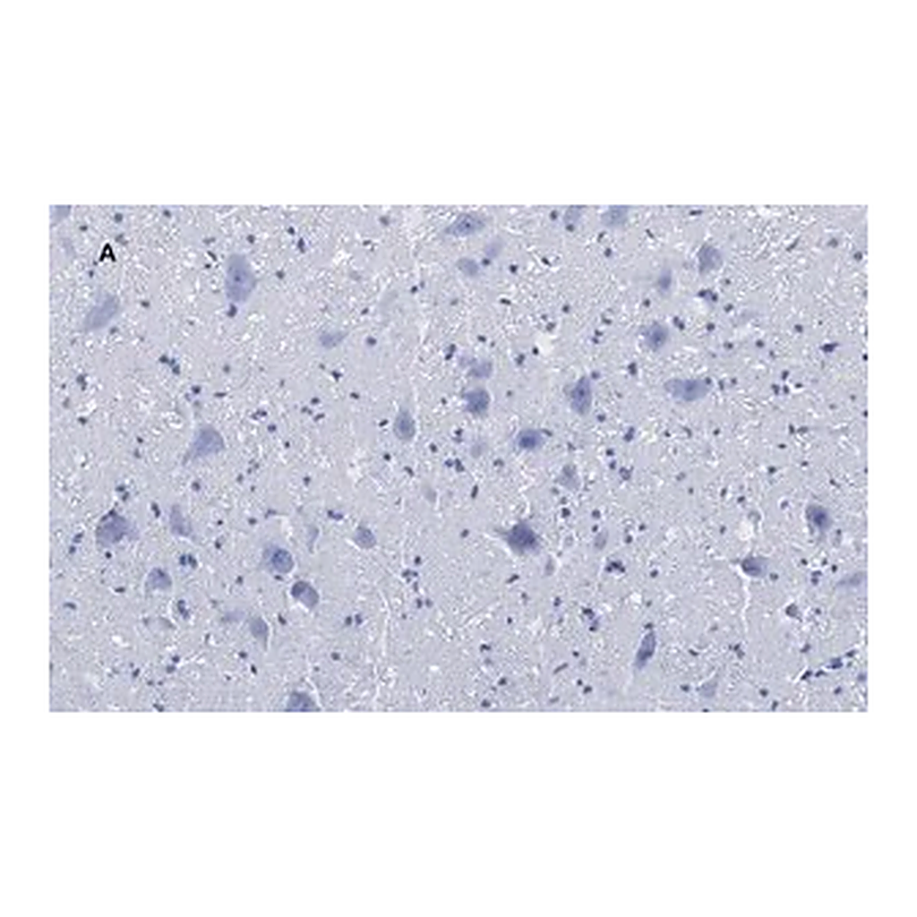 Merck Anti-Choline Acetyltransferase (ChAT) Antibody, clone 2K16, ZooMAb Rabbit Monoclonal