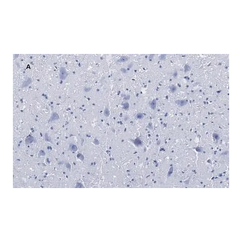 Merck Anti-Choline Acetyltransferase (ChAT) Antibody, clone 2K16, ZooMAb Rabbit Monoclonal