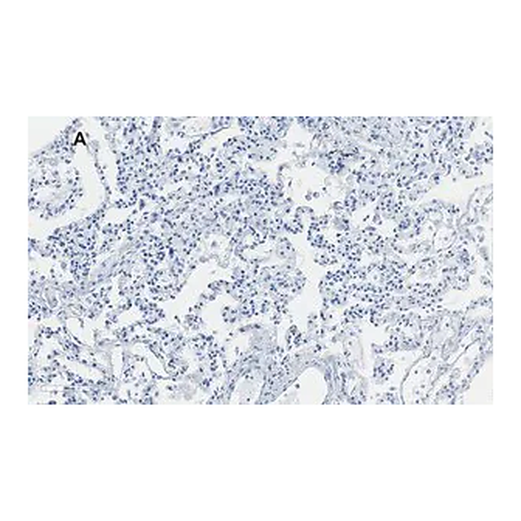 Merck Anti-Integrin alpha V beta 6 Antibody, clone EM05201, ZooMAb Rabbit Monoclonal