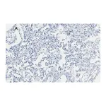 Merck Anti-Integrin alpha V beta 6 Antibody, clone EM05201, ZooMAb Rabbit Monoclonal