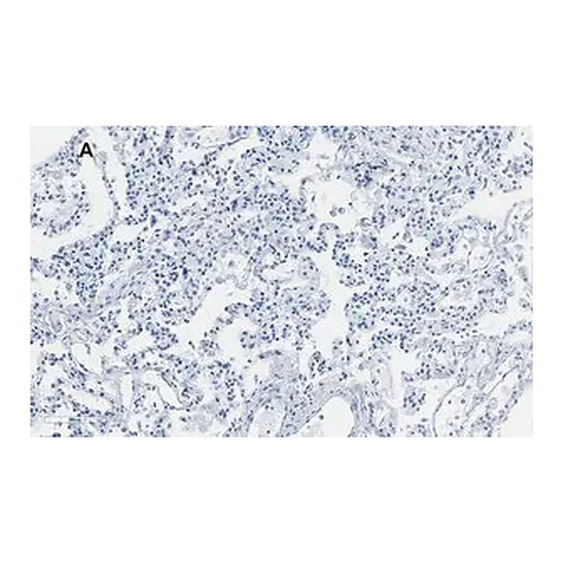 Merck Anti-Integrin alpha V beta 6 Antibody, clone EM05201, ZooMAb Rabbit Monoclonal