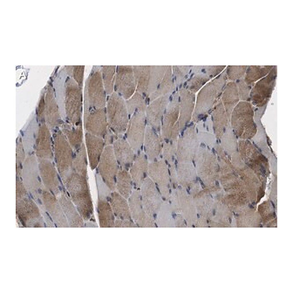 Merck Anti-CACNA2D1 Antibody, clone 1K4 ZooMAb Rabbit Monoclonal