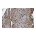 Merck Anti-CACNA2D1 Antibody, clone 1K4 ZooMAb Rabbit Monoclonal