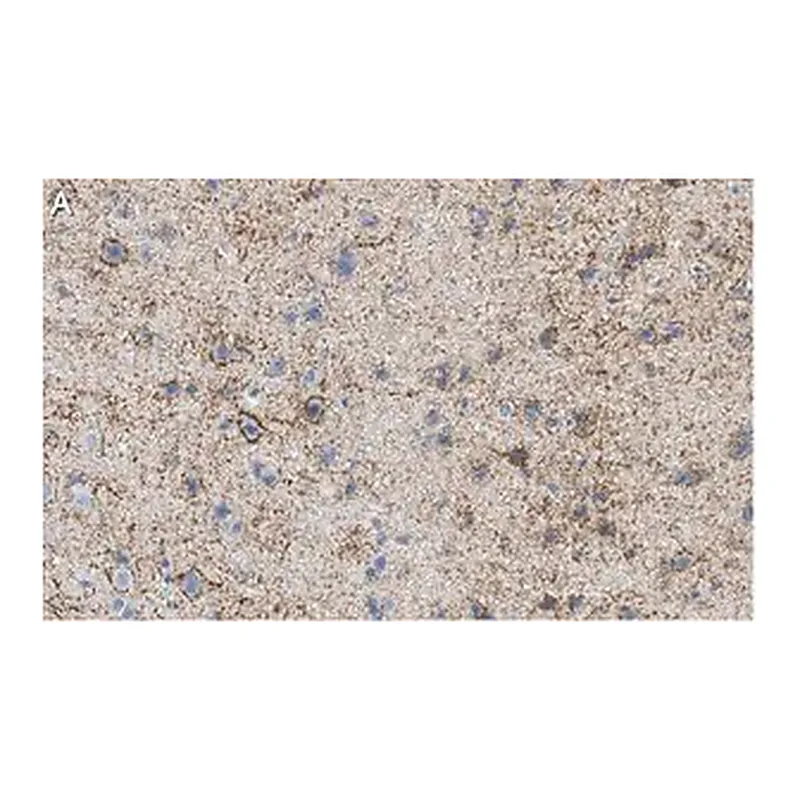 Merck Anti-GAD67 Antibody, clone 1G10.2 ZooMAb Mouse Monoclonal