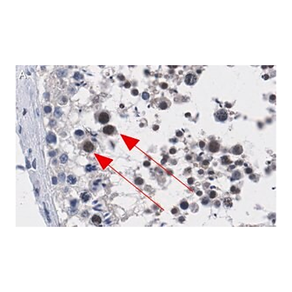 Merck Anti-ATR Antibody, clone 1B15 ZooMAb Rabbit Monoclonal