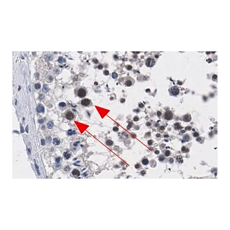 Merck Anti-ATR Antibody, clone 1B15 ZooMAb Rabbit Monoclonal