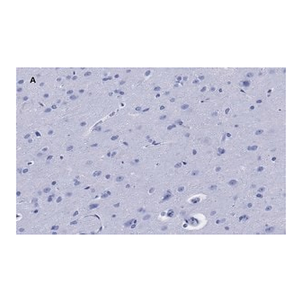 Merck Anti-GFAP Antibody, clone 2E8, ZooMAb Rabbit Monoclonal