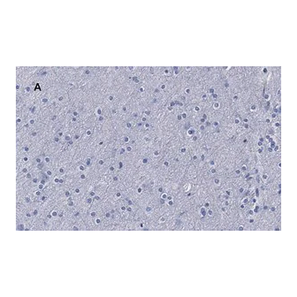 Merck Anti-β-Tubulin III Antibody, clone 5H16, ZooMAb Rabbit Monoclonal