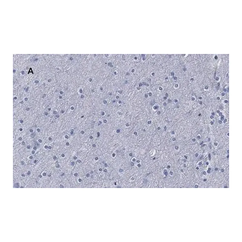 Merck Anti-β-Tubulin III Antibody, clone 5H16, ZooMAb Rabbit Monoclonal
