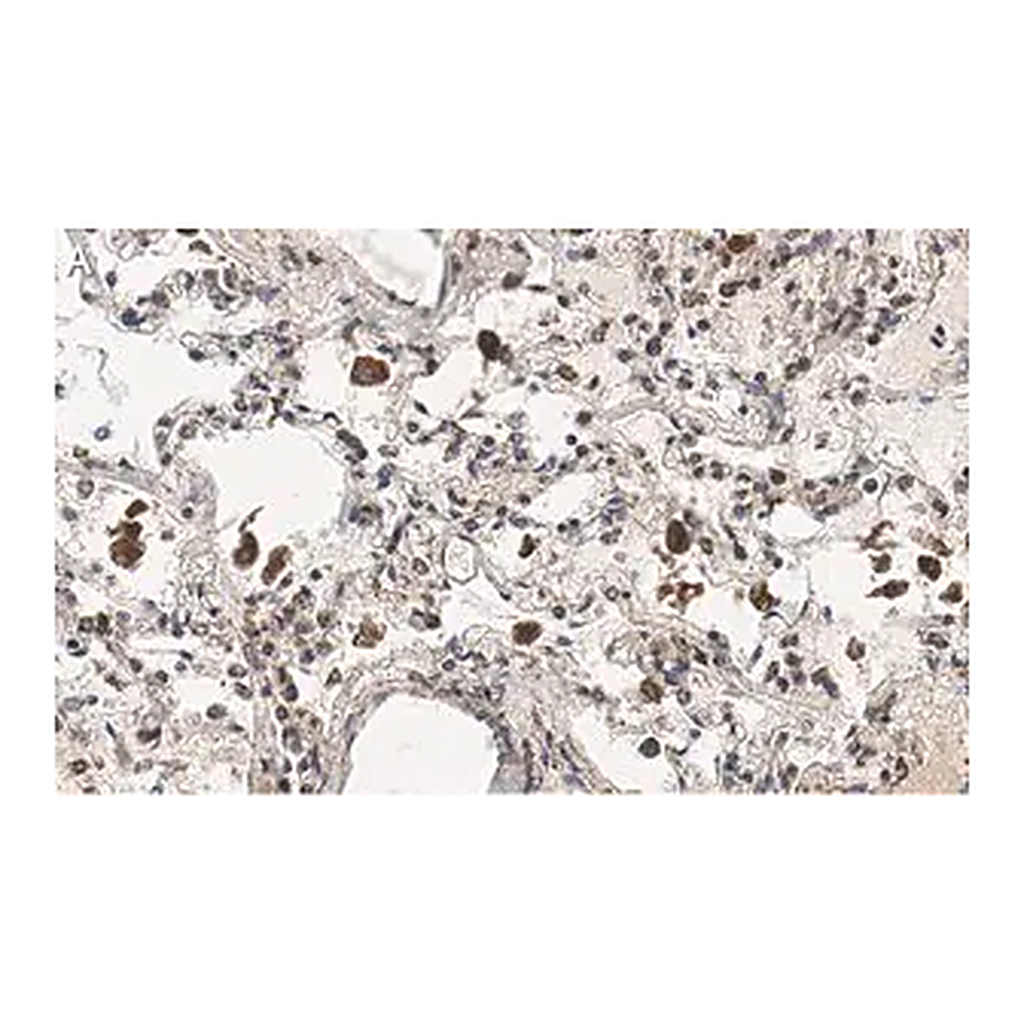 Merck Anti-MRC1 Antibody, clone 1C9 ZooMAb Rabbit Monoclonal