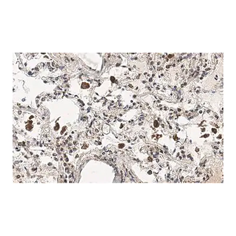 Merck Anti-MRC1 Antibody, clone 1C9 ZooMAb Rabbit Monoclonal