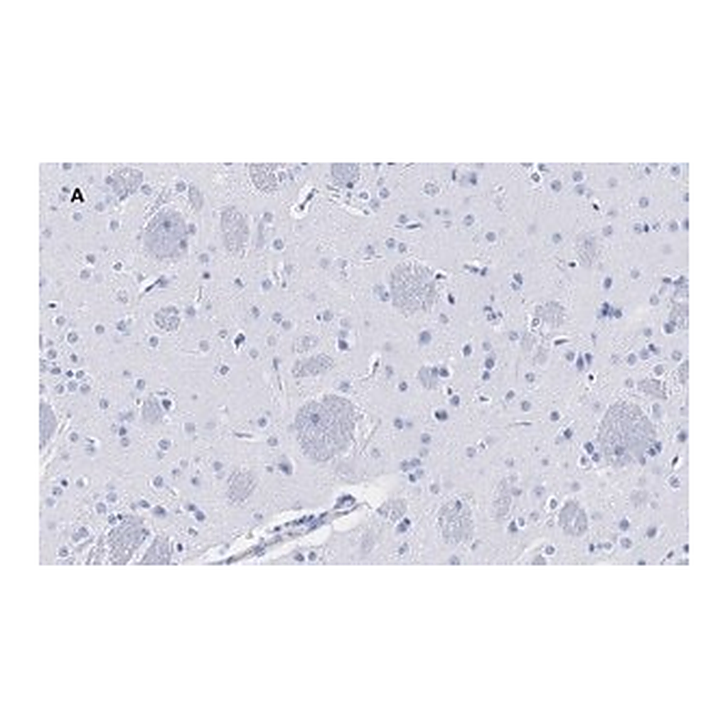 Merck Anti-Tyrosine Hydroxylase Antibody, clone 3M12, ZooMAb Rabbit Monoclonal