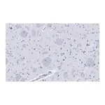 Merck Anti-Tyrosine Hydroxylase Antibody, clone 3M12, ZooMAb Rabbit Monoclonal