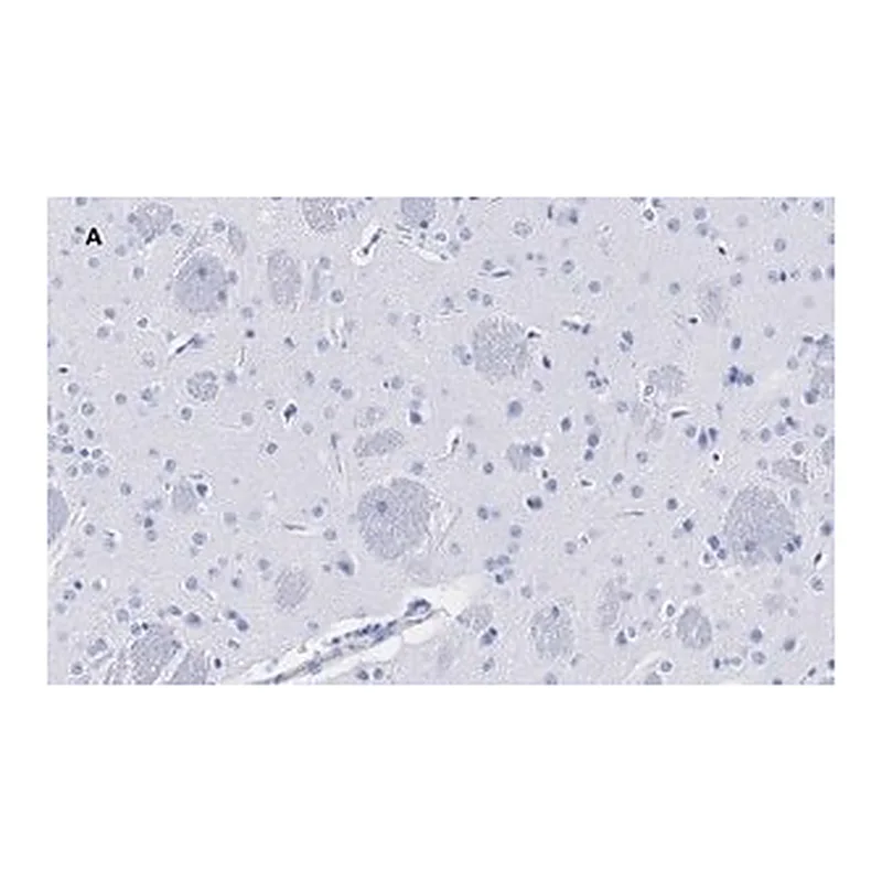 Merck Anti-Tyrosine Hydroxylase Antibody, clone 3M12, ZooMAb Rabbit Monoclonal