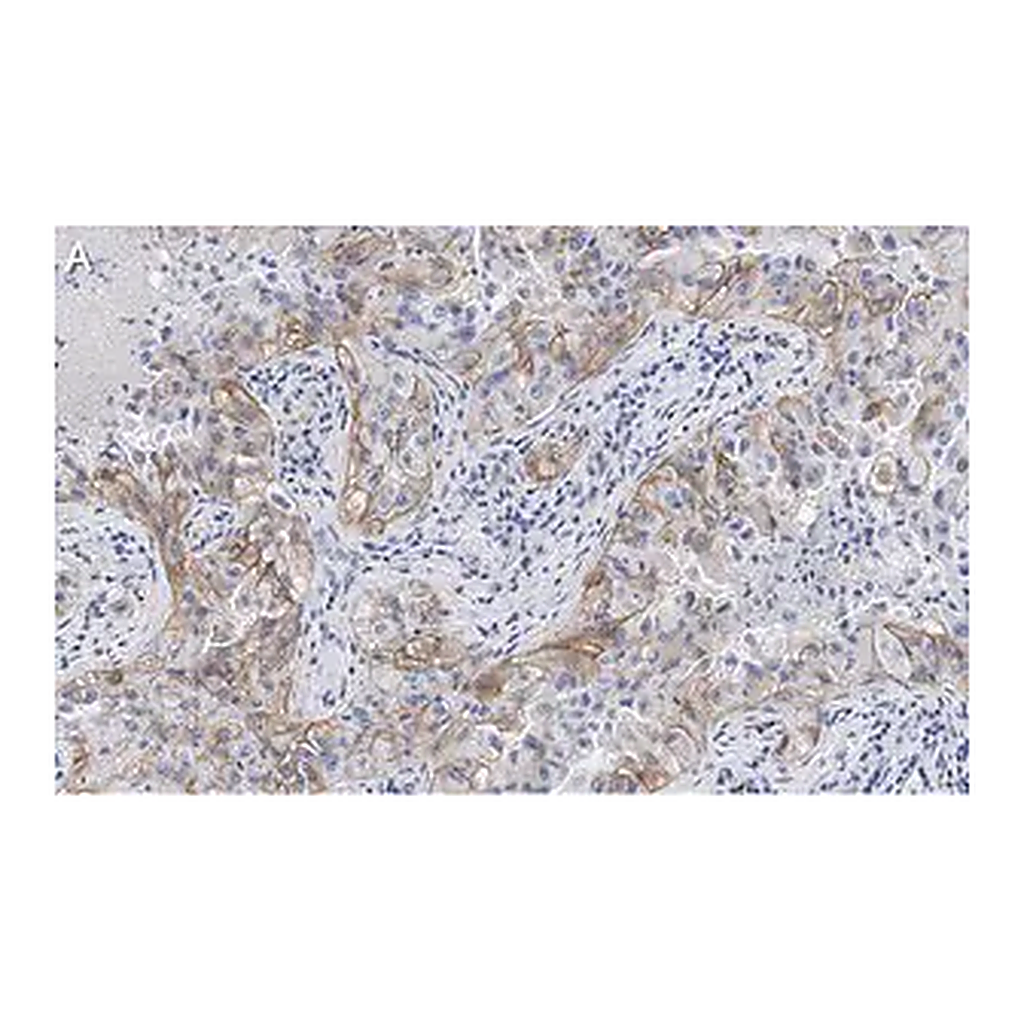 Merck Anti-Integrin αVβ3 Antibody, clone EM22703 ZooMAb Rabbit Monoclonal