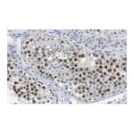 Merck Anti-RAD51 Antibody, clone 1M8 ZooMAb Rabbit Monoclonal