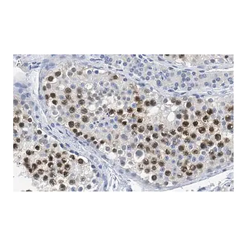 Merck Anti-RAD51 Antibody, clone 1M8 ZooMAb Rabbit Monoclonal