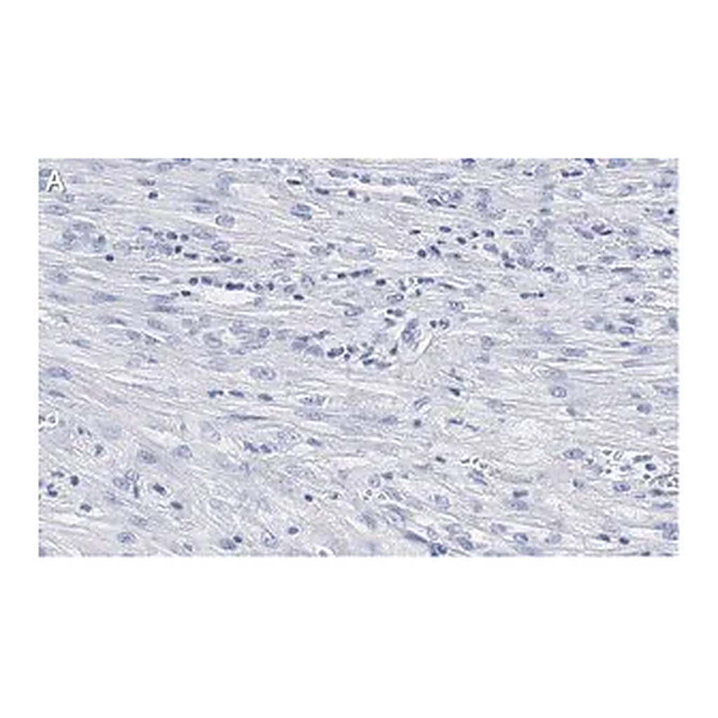 Merck Anti-β-Actin Antibody, clone 6L12, ZooMAb Rabbit Monoclonal