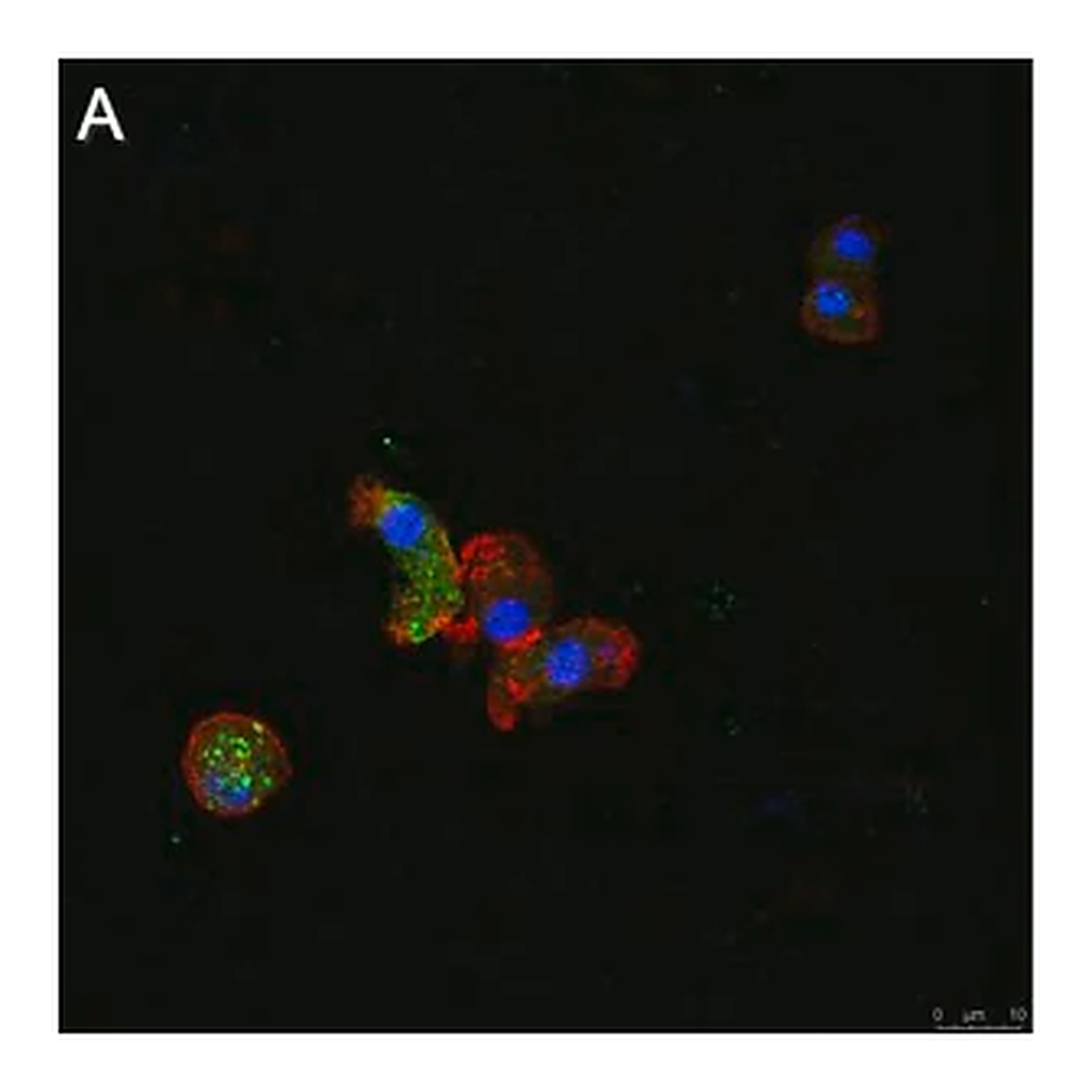 Merck Anti-ATG8 Antibody, clone 2B11 ZooMAb Rabbit Monoclonal