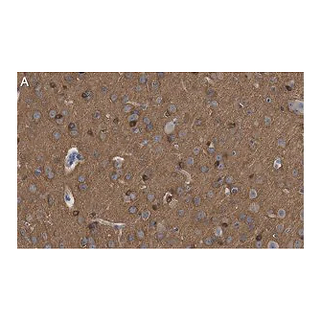 Merck Anti-Tau-1 Antibody, clone PC1C6 ZooMAb Mouse Monoclonal