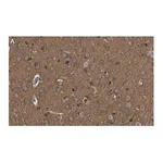 Merck Anti-Tau-1 Antibody, clone PC1C6 ZooMAb Mouse Monoclonal